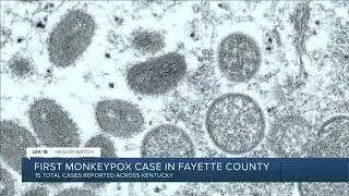 First monkeypox case in Fayette County