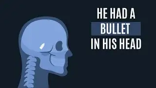 Florida Man’s Headache Mystery Solved