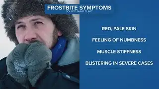 Frostbite risk increases as subzero wind chills grip Northeast Ohio
