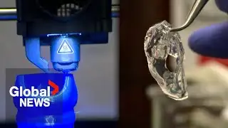 “Game changer”: 3D-printing breakthrough could transform chronic lung disease