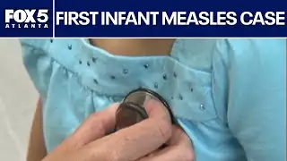 Georgia reports first 2026 measles case in infant | FOX 5 News