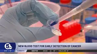 GRAIL Galleri blood test provides hope for early cancer screening