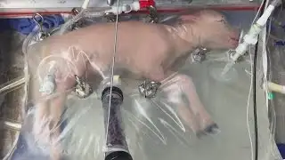 Groundbreaking artificial womb could save premature babies