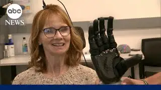 Groundbreaking prosthetics that feel touch