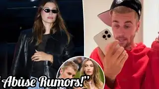 "Hailey Bieber Ditches Wedding Ring – Abuse Allegations Rock Justin!"🔥