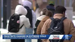 Health experts warn of cold weather dangers in Milwaukee