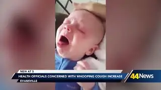 Health officials concerned over increase in whooping cough cases