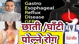 Heart burn problems in Nepali. धेरैलाई हुने छाती /घाँटी पोल्ने समस्या। #reflux