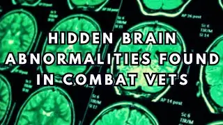 Hidden Brain Abnormalities Found in the Brains of Combat Veterans