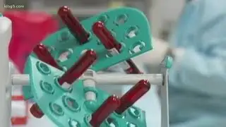 HIV cleared in second patient