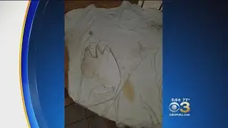 Homeowner Survives Bear Attack In Garage