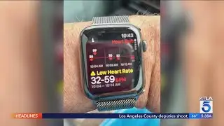 How An Apple Watch Saved One Man