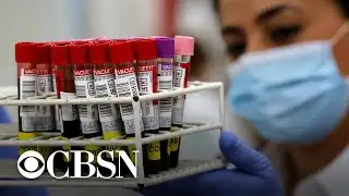 How "super" antibodies could help create a coronavirus vaccine