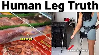 human leg Supermarket viral Video Debunked: Leg Shown Is Camel Meat, Not Human