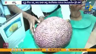 చూపులేని వారికి సైన్స్ చేరువ, IITమద్రాస్ 3డీ చొరవ | IIT Madras Unveils 3D Hall for Visually Impaired