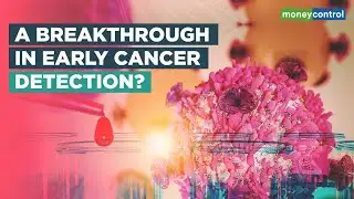 Indian Startup Achieves Breakthrough In Early Cancer Detection
