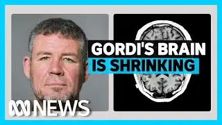 Inside the brain of a suspected CTE patient | ABC News