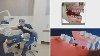 Investigation reveals dentists convincing patients to pull teeth