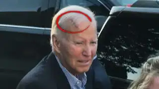 Joe Biden Appears to Have Large Gash on Head
