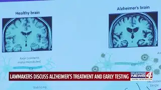 Lawmakers discuss Alzheimer