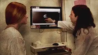 Mammography Guidelines Toned Down by USPSTF