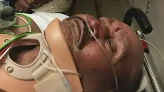 Man, 84, Hospitalized After St. James Assault