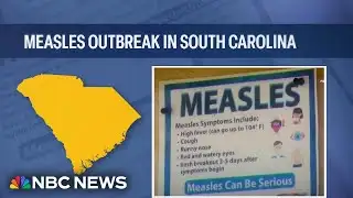 Massive measles outbreak in South Carolina surges