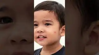 Measles Alert Across the Americas