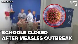 Measles outbreak declared in Washington state county as 3 local children test positive