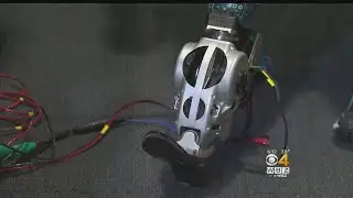 Mind-Controlled Bionic Limbs Developed At MIT