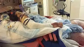 Misdiagnosis leads to double amputation for little girl