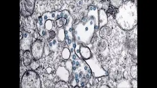 MORNING RUSH: Top headlines for March 9th, 2020