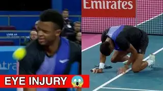 Mpetshi Perricard Hits Ball in Eye | Perricard Eye Injury Montpellier