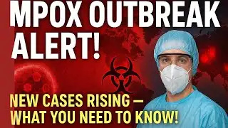 MPOX OUTBREAK ALERT Subhead line smaller text New Cases Rising What You Need to Know