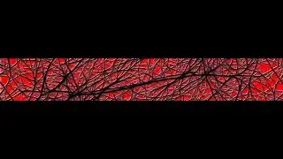 Multiple sclerosis  21 1  2026