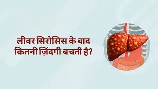 लीवर सिरोसिस के बाद कितनी ज़िंदगी बचती है?
