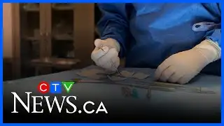 N.B. kids face long waitlists for dental surgery