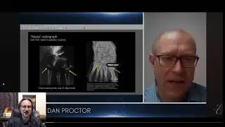 Nazca Mummy Update! Fighting the Disinformation!