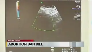 NC lawmakers considering bill that would ban some abortions