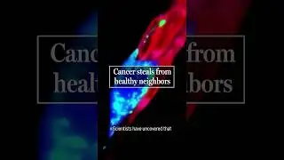 Neurons make a deadly donation to cancer cells