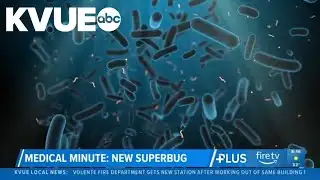 New superbug raising concerns among some US health experts