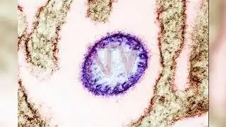 NIPAH VIRUS EXPLAINED: Health officials call for calm