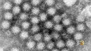Norovirus outbreaks have increased this season