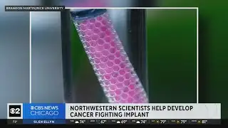 Northwestern scientists developing cancer-fighting implant