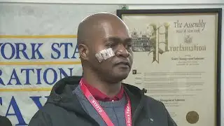 NYC taxi driver speaks out after getting shot in face