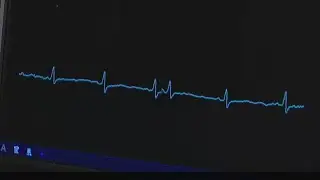 Ochsner : Why Are Heart Attack More Common Around the Holidays