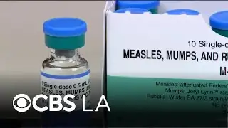 Orange County confirms measles case in young adult