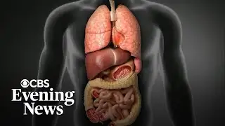 Ozempic and Wegovy ingredient may reverse liver disease