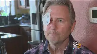 Paintball Attack Victim Shares His Story