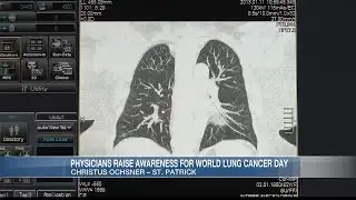 Physicians raise awareness for World Lung Cancer Day